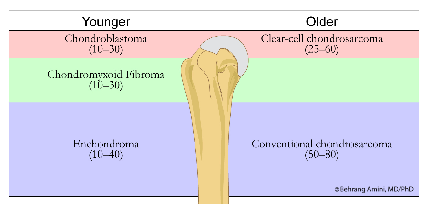 the humerus is an example of a bone