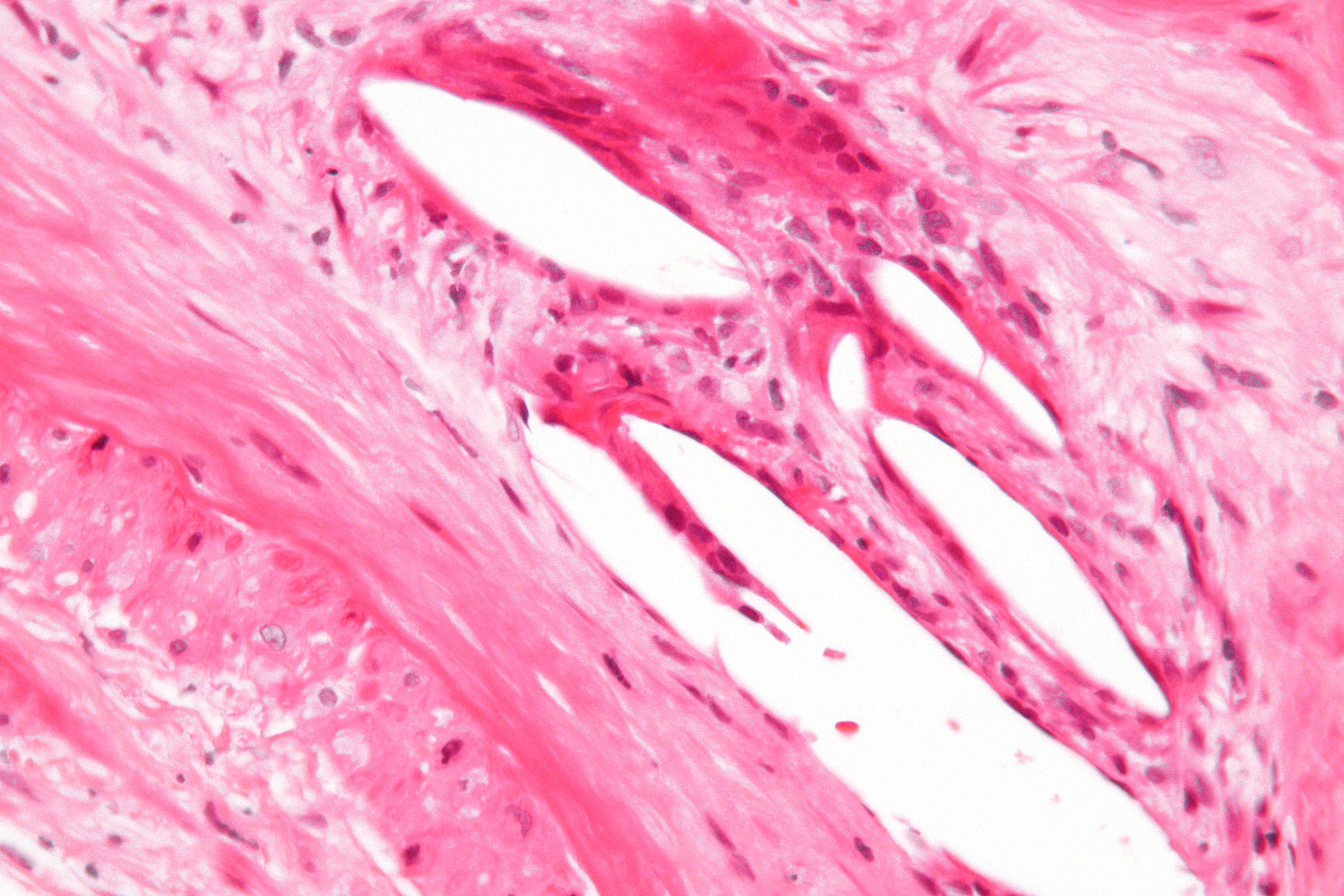 an example of connective tissue